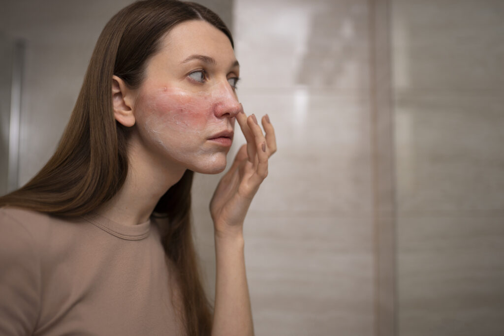 Alergi Sunscreen